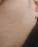 20180223 094032